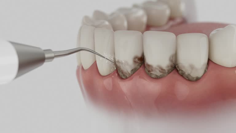 Trusted Emergency Dentist service in St. Peters, MO - Dentist Open Now